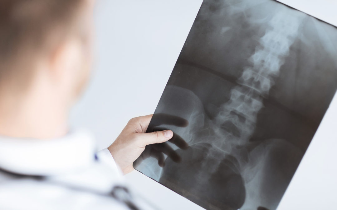 Ai-je besoin d’une radiographie ou d’une IRM ?